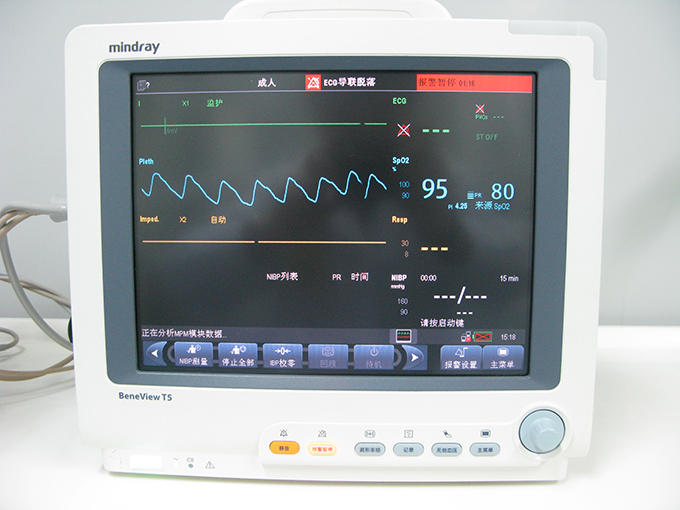 心电监护仪生产厂家(心电监护仪品牌国产哪个最好)